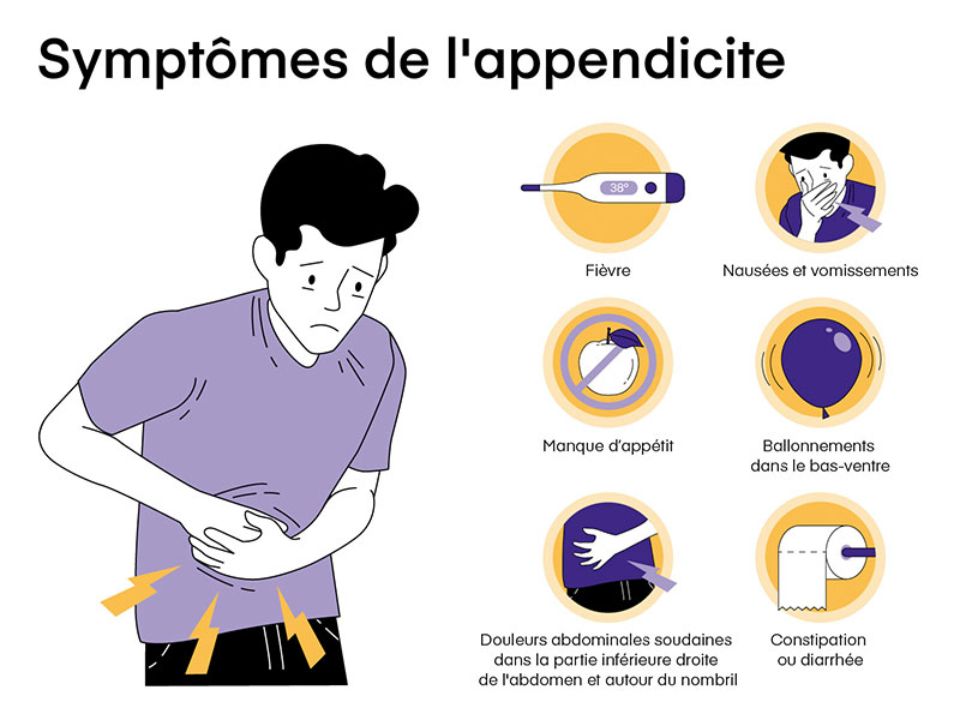 Appendicite: que faire en cas d'urgence? | Visana Blog